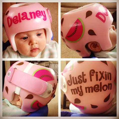 Helmet for Plagiocephaly | Baby helmet, Baby pictures, Plagiocephaly helmets