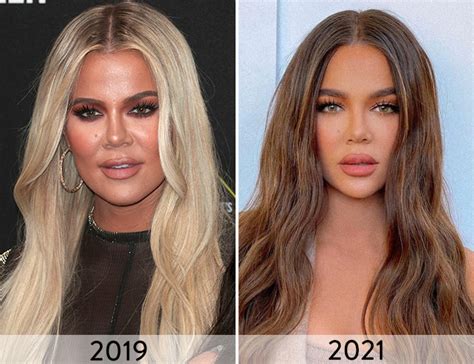 Khloé Kardashian Then & Now: See How Much Her Face Has Changed Over The ...