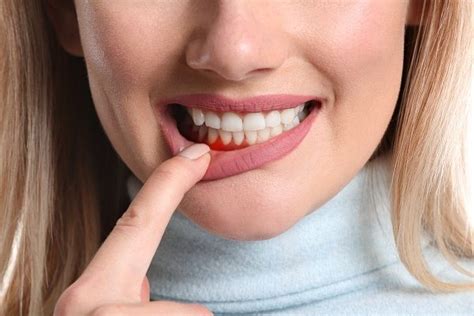 Gum Disease Treatment: 5 Signs You May Have Gum Disease - Casas Adobes Dentistry Tucson Arizona