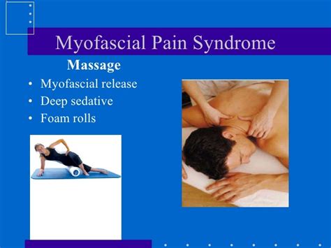 Myofascial pain syndrome