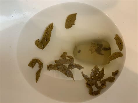 Warning Poop: does this look consistent with fatty stool? Normal diet and fecal elastase >500 ...