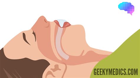 Oropharyngeal Airway (Guedel Airway) Insertion - OSCE Guide | Geeky Medics