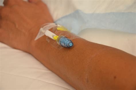 8.2 Intravenous Fluid Therapy – Clinical Procedures for Safer Patient Care