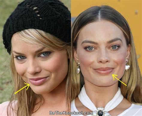 Margot Robbie Plastic Surgery Comparison Photos