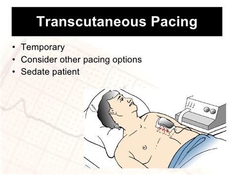 Defibrillation