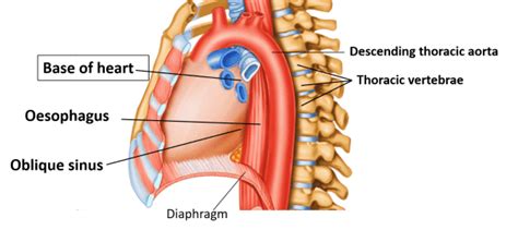 Heart – External Features – Anatomy QA