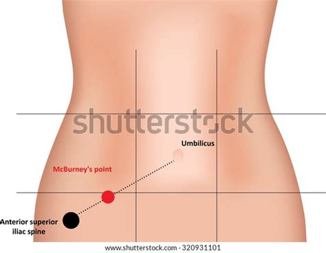 7 Mcburney's Point Images, Stock Photos, and Vectors | Shutterstock