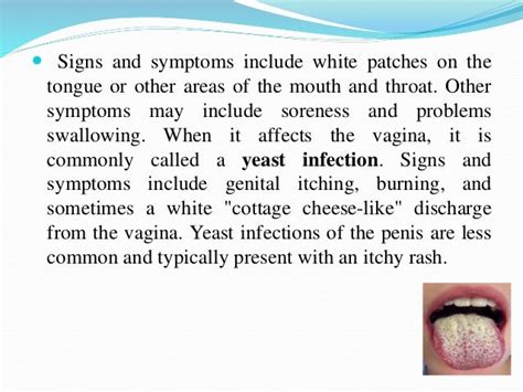 Candidiasis, causes and their treatment