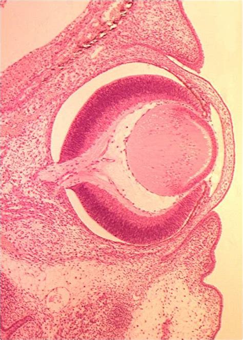 Eye and Ear Histology resource - WikiVet English
