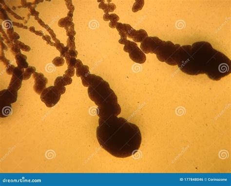 Fungi and Bacteria Under the Microscope Stock Photo - Image of microbiology, view: 177848046