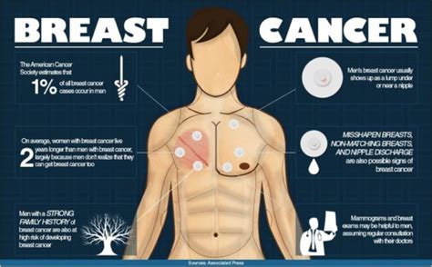 Breast Cancer Can and Does Happen to Men