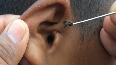 ear wax removal chch - Glenda Kutchar