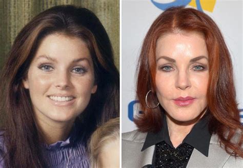 Priscilla Presley Plastic Surgery Gone Wrong - Plasticsurgerytalks.com