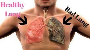 Is Vaping Bad For Your Lungs? - Public Health