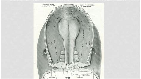 DEVELOPMENT OF BODY CAVITIES - YouTube