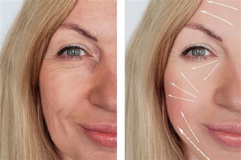 Face yoga before and after photos