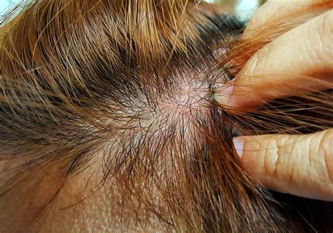 4 Coffee Hair Dye Side Effects You Must Know – HairstyleCamp