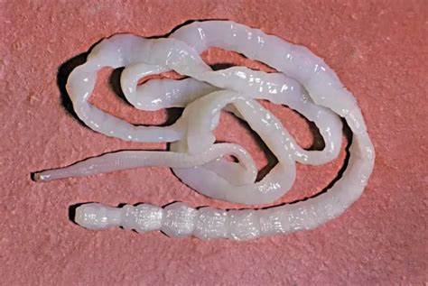 Tapeworm Vs Pinworm: What Is The Difference?