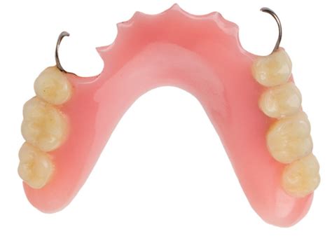 Parts Of A Removable Partial Denture - Design Talk