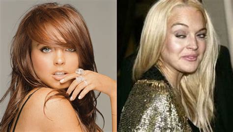 25 Celebrities Who Botched Their Looks With Plastic S - vrogue.co