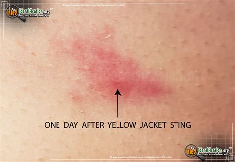 Details more than 135 yellow jacket pain best - jtcvietnam.edu.vn