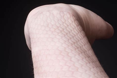 Image result for watch skin imprint | Snake skin pattern, Snake skin, Skin marks