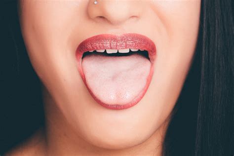 Do you suffer from 'acid reflux tongue'?