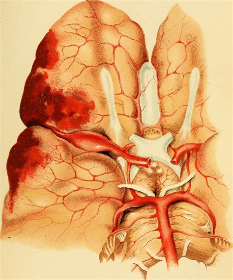 Grand Mal seizure symptoms | General center | SteadyHealth.com