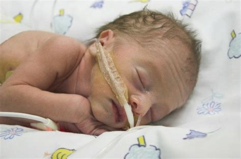 Premature Birth Complications: Everything You Should Know About It