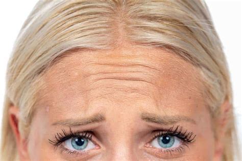 FDA OKs Xeomin® for frown lines - AAFE - American Academy of Facial Esthetics Blog