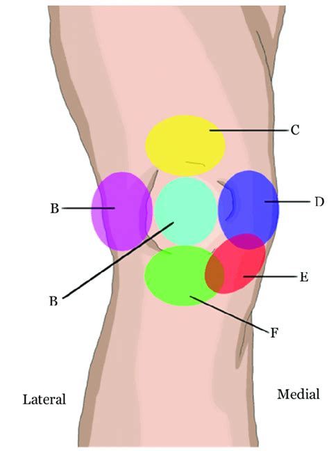 Back Knee Pain Location Chart