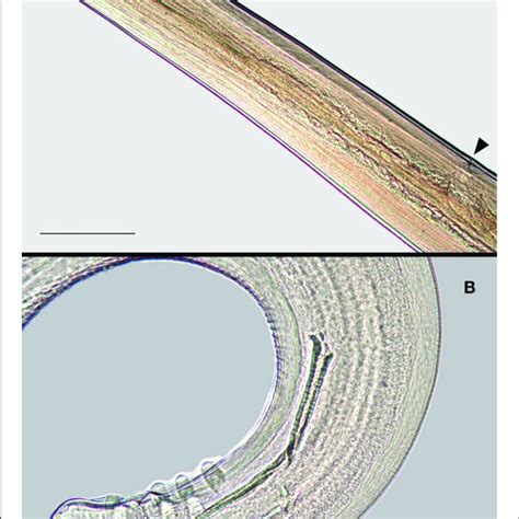 | Adult Dirofilaria immitis. Anterior extremity of the female (A ...