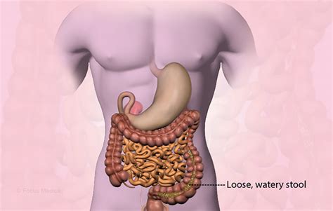 Health Condition : Symptoms, Causes, Treatment and More