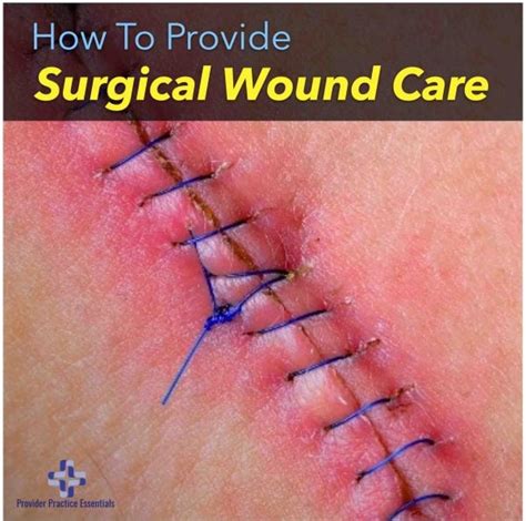 Providing Surgical Wound Care And Understanding the types of healing