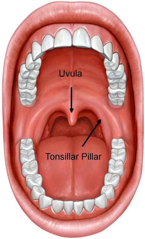 Tonsillitis Grading