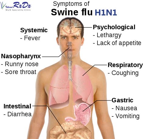 H1N1 Swine Flu - Causes, Signs, Symptoms, Diagnosis & Treatment - RxDx Healthcare