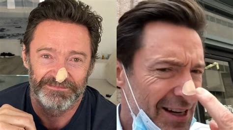 Hugh Jackman Skin Cancer scare - Latest Update