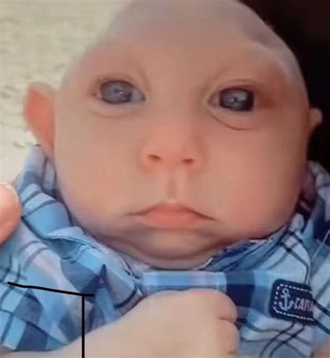 Deformed baby in 2024 | Deformed babies, Chubby babies, Really funny memes