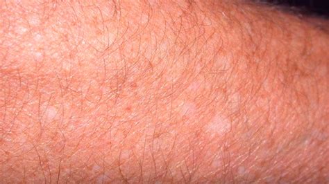 White Spots on Skin: What’s Causing It?