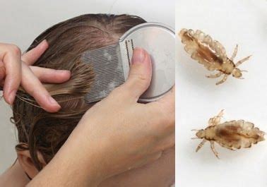 Pin by Karen Franco on Lice Removal - Advice on Lice | Lice removal, Lice removal service, Home ...