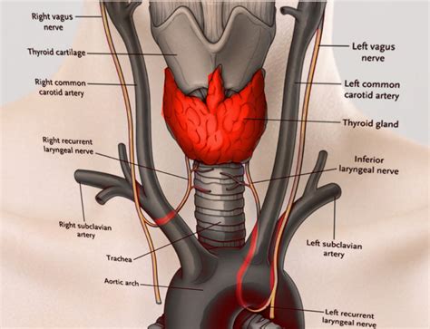 [Figure, Recurrent laryngeal nerves Image courtesy S Bhimji MD ...