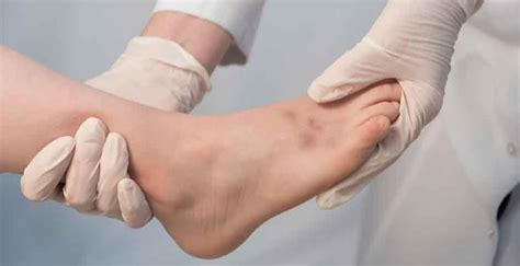 Understanding and Treating a Sprained Big Toe: Causes, Symptoms, and ...