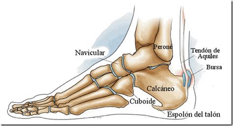 Consejos Para Poder Lidiar con el Dolor del Espolón Calcáneo (con ...