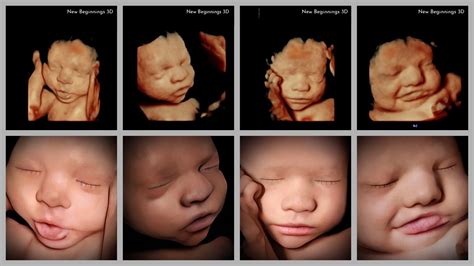 Home - New Beginnings 3D Ultrasound