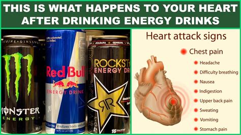 These Are The Horrific Side-Effects of Energy Drinks On Your Body