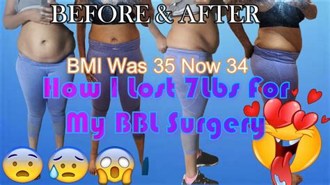 My BBL & LIPO 360 Journey How I Got My BMI To 34 & 1 Month | Getting Labs Done - YouTube