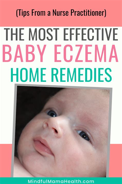 Safe and Effective Baby Eczema Natural Remedies - Mindful Mama Health ...