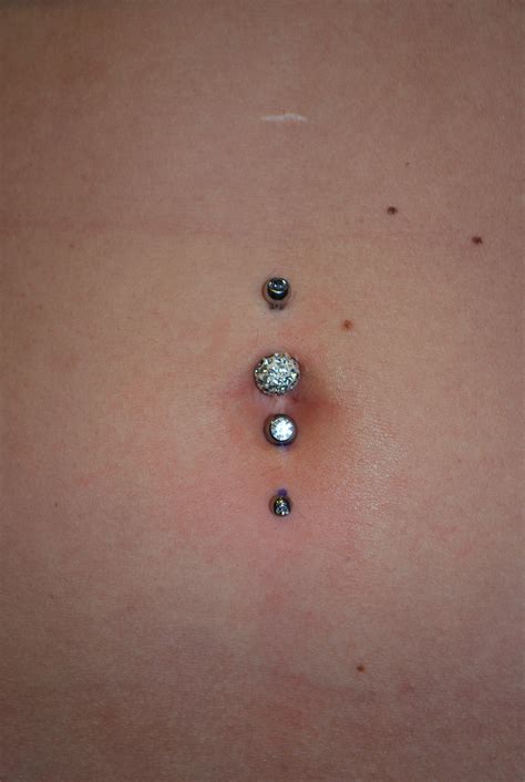 Navel Piercing Scar Tissue at Tasha Mahoney blog