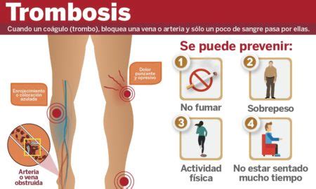 día mundial de la trombosis – Imagen Global