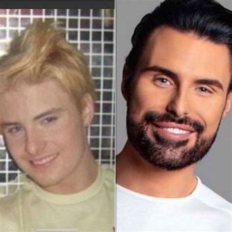 The Best 10 Rylan Clark Before Teeth - factimagemountain